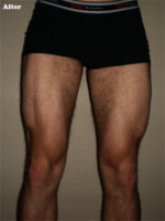 after legs.jpg