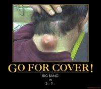 spot-the-pimple-and-zit-down-in-cover-gross-pus-squeeze-demotivational-poster-1288904609.jpg