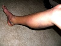 leg1.jpg