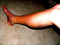 leg1.jpg