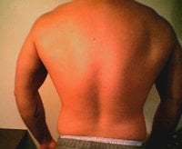 pics of my back001.jpg