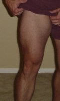 Leg.JPG