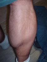 leg.JPG