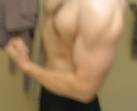 after arm.JPG