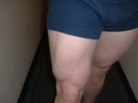 1leg 4-9.JPG