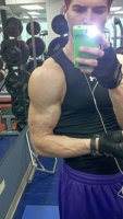dylanvascular4.jpg