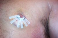 surgery 001.jpg