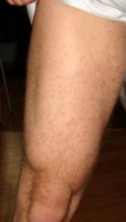 Right Leg.JPG