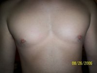 gyno 002.jpg