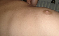 gyno-026edit.jpg