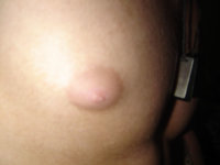gyno-031edit.jpg