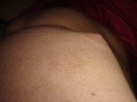 gyno-033edit.jpg