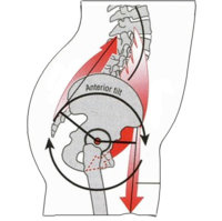 anterior-pelvic-tilt21.jpg