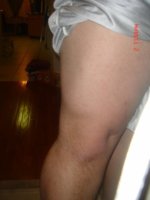 Leg.jpg