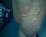 legs.jpg