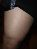 Leg.jpeg