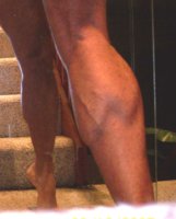 Rt Calf.jpg