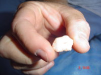 Removed Bone.JPG