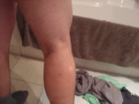 Leg.JPG