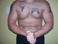 ad lifting 002.jpg