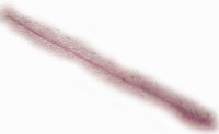 Scar-011708.jpg