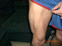 new leg.jpg