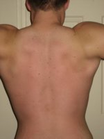 SmallBack.jpg