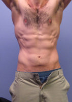 front-flex-2-23.jpg
