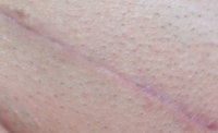 Scar-021508.jpg