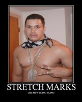 STRETCHMARKS.jpg
