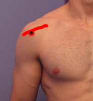 shoulder.jpg