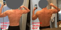 back flex before after.jpg